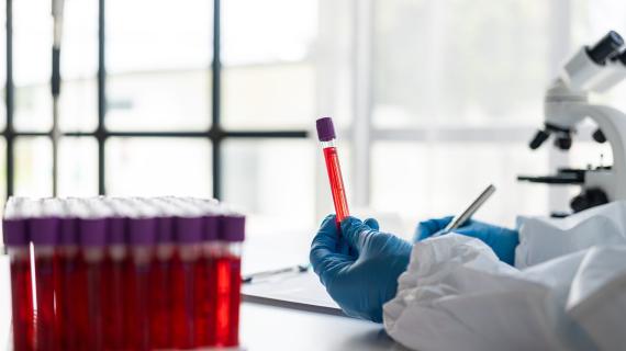 Faceless lab tech holds a red test tube with blue gloves and all white garb. 