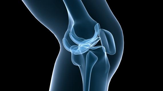 An x-ray like image of a knee.