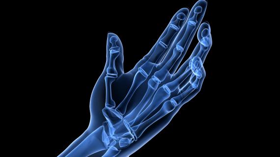 X-ray like image of the hand